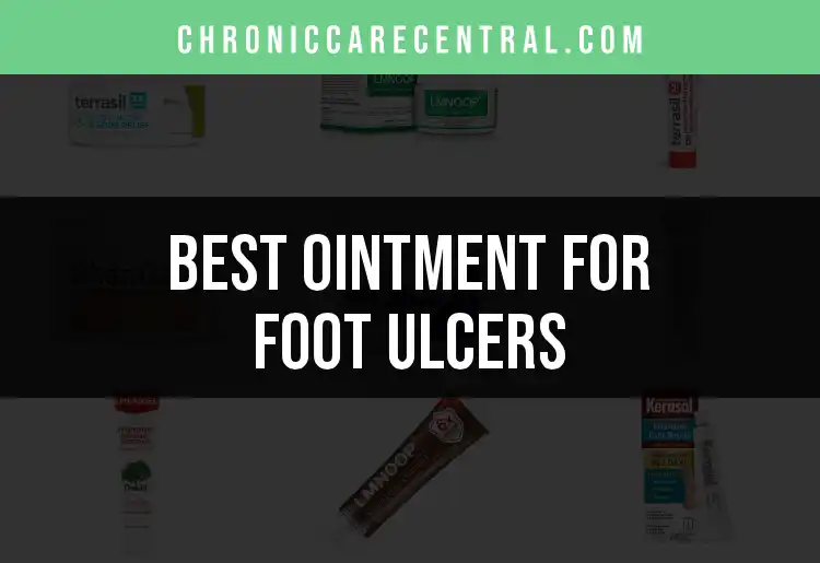 14 Top Ointments for Foot Ulcers You Should Know